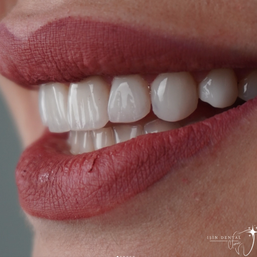 Before and After Treatment 1